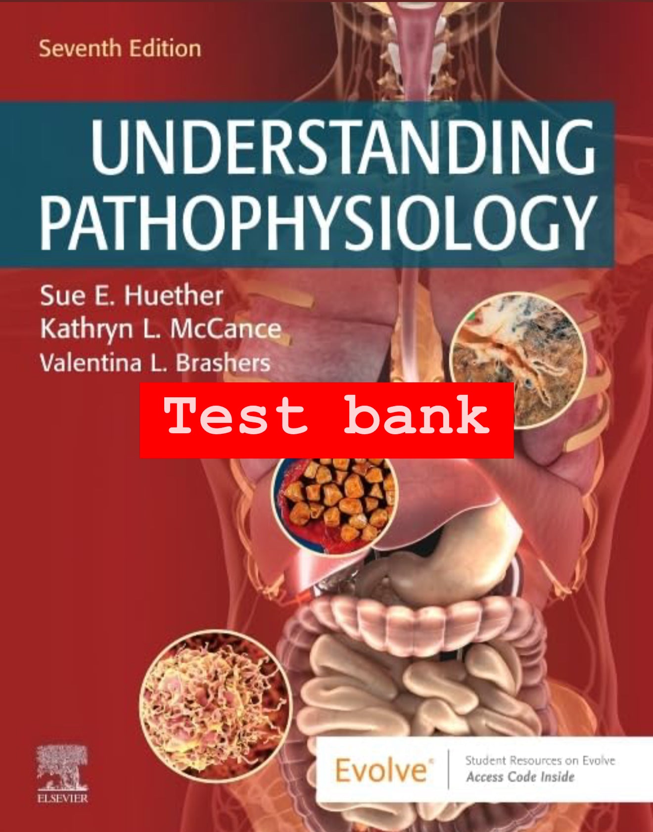 Test Bank for Understanding Pathophysiology – 7th Edition (Huether & McCance)
